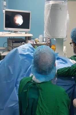 Tán sỏi san hô “khủng” cho bệnh nhân ở tư thế nằm ngửa