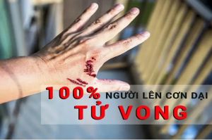 Cần làm gì khi bị chó dại cắn?