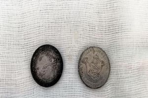 Cảnh báo tai nạn nuốt dị vật nguy hiểm ở trẻ em