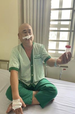 Mắt phải giật liên tục, đi khám mới biết có u nang thân răng mọc trong xoang hàm