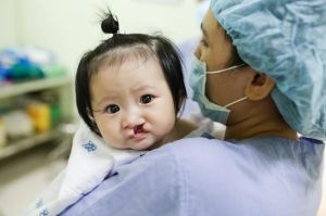 Phẫu thuật miễn phí cho trẻ bị dị tật sứt môi, hở hàm ếch
