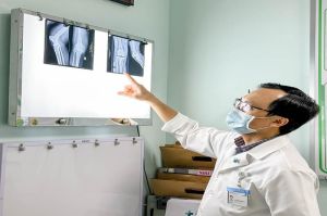 Cụ ông bị thoái hóa khớp gối nặng được thay toàn bộ khớp gối