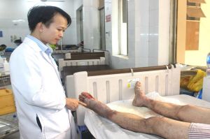 Quản lý công trình xây dựng bị thợ hồ tẩm xăng đốt trong đêm gây bỏng nặng