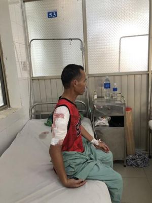 Tự đắp lá cây lên chỗ đau, bệnh nhân phải mổ cắt lọc vai