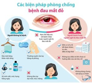 Hơn 18 ngàn người bị đau mắt đỏ