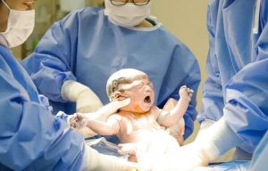 Cứu sống bé gái sinh non bị dây rốn quấn 5 vòng quanh cổ hiếm gặp