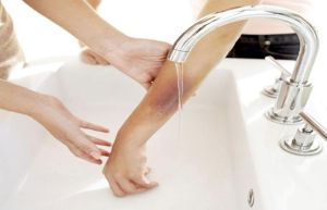 Cấp cứu bé trai 13 tháng tuổi bị bỏng nước sôi nặng