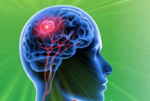 Phẫu thuật thành công ca u não