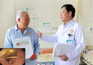 Bệnh nhân suýt thủng dạ dày vì nuốt phải xương cá