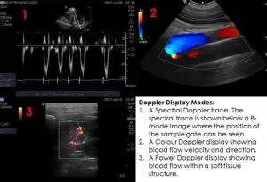 Bệnh viện Đa khoa khu vực Định Quán triển khai kỹ thuật mới về thăm dò chức năng