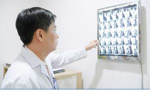 Phẫu thuật nội soi tái tạo dây chằng chéo cho bệnh nhân bị chấn thương thể thao