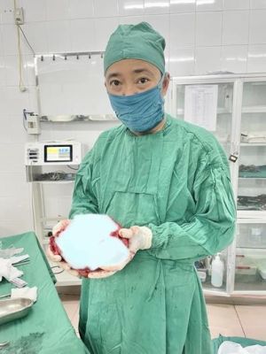 Phẫu thuật bóc tách khối u xơ tử cung rất to cho bệnh nhân