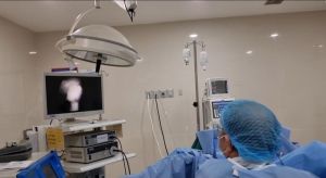 Phẫu thuật thành công sỏi san hô thận trái phức tạp cho người bệnh