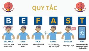 Điều trị đột quỵ trong giờ vàng để tăng cơ hội sống cho bệnh nhân