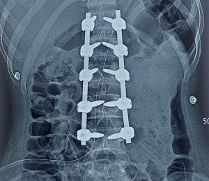 Bệnh viện Đa khoa khu vực Long Khánh thực hiện ca mổ thành công ngoài mong đợi