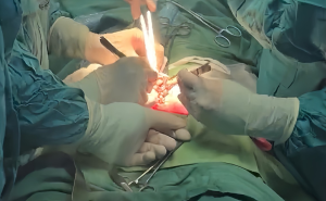 PHAU THUAT KIP THOI CUU SONG BENH NHAM VIEM PHUC MANG DO THUNG DAI TRANG