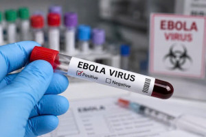 Phường Đồng Xoài chủ động triển khai các biện pháp phòng, chống dịch bệnh do vi rút Ebola