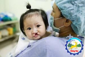 Chương trình phẫu thuật miễn phí dị tật vùng hàm mặt tháng...