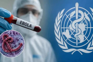 PHÒNG, CHỐNG DỊCH BỆNH EBOLA