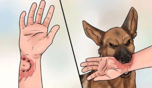 Mức độ nguy hiểm của bệnh dại