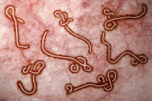 Tích cực phòng chống bệnh do vi rút Ebola trên địa bàn phường Nhơn Trạch docx