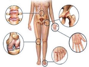 Điều trị kết hợp trong bệnh viêm khớp dạng thấp