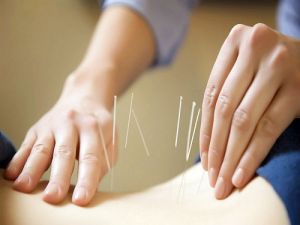 Điều trị thoát vị đĩa đệm hiệu quả bằng y học cổ truyền