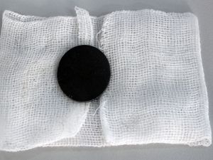 Gắp thành công đồng xu trong dạ dày bé trai 6 tuổi