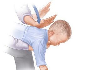 Hóc dị vật ở trẻ: Hậu quả khó lường