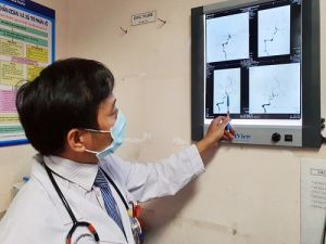 Cứu sống hai bệnh nhân bị đột quỵ bằng phương pháp tiêu sợi huyết