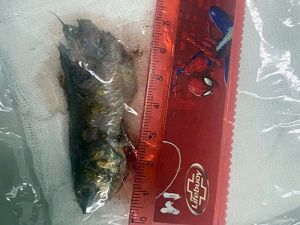 Bé trai bị cá rô chui vào cổ họng khi đang chơi