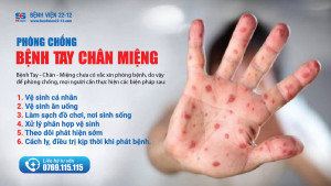 Phòng chống bệnh tay chân miệng
