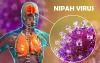 DỊCH BỆNH CHO VI RÚT NEPAH VÀ CÁC BIỆN PHÁP PHÒNG CHỐNG