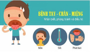 01 01 2026 Tăng cường công tác phòng, chống dịch bệnh Tay chân miệng trên địa bàn xã Trị An