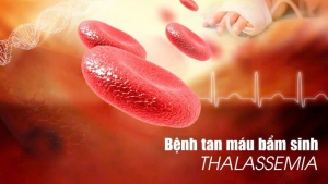 THÔNG TIN CHUNG NGÀY THALASSEMIA THẾ GIỚI 8/5