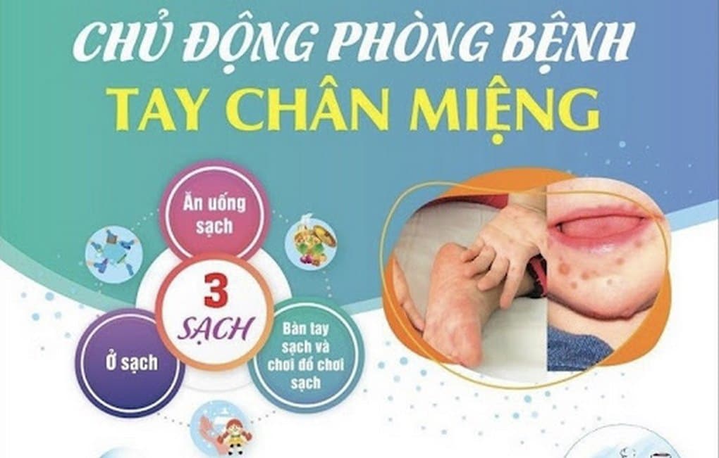 Xã An Phước - Chủ động triển khai đồng bộ các biện pháp phòng, chống bệnh Tay – Chân – Miệng