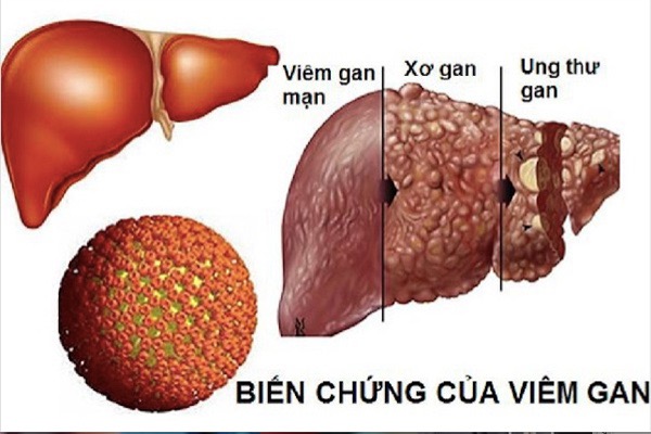 viem gan B - la gan.jpg?t=1752456061