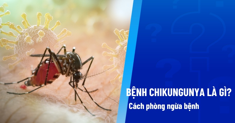 Nguy cơ bùng phát bệnh Chikungunya: Bộ Y tế phát đi khuyến cáo khẩn tới toàn dân