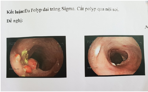 Noi Soi Polyp.png?t=1758876325