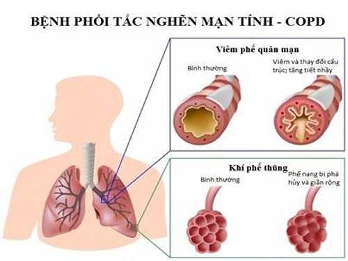 phoi tac ngen.jpg?t=1757037856