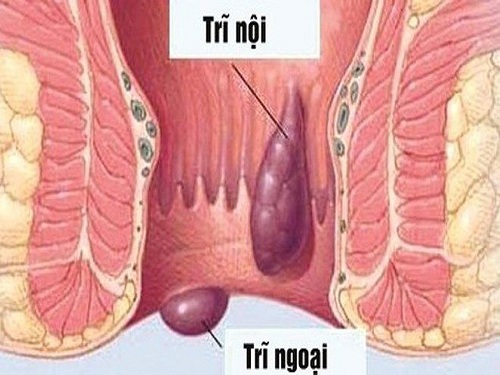 trỉ.jpg?t=1757037856