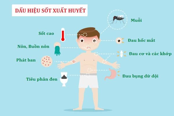 SXH 01