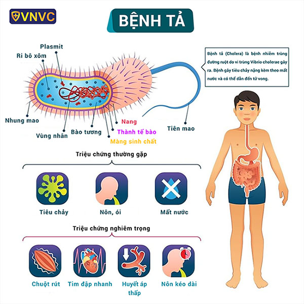 CÁC BIỆN PHÁP PHÒNG CHỐNG BỆNH TẢ